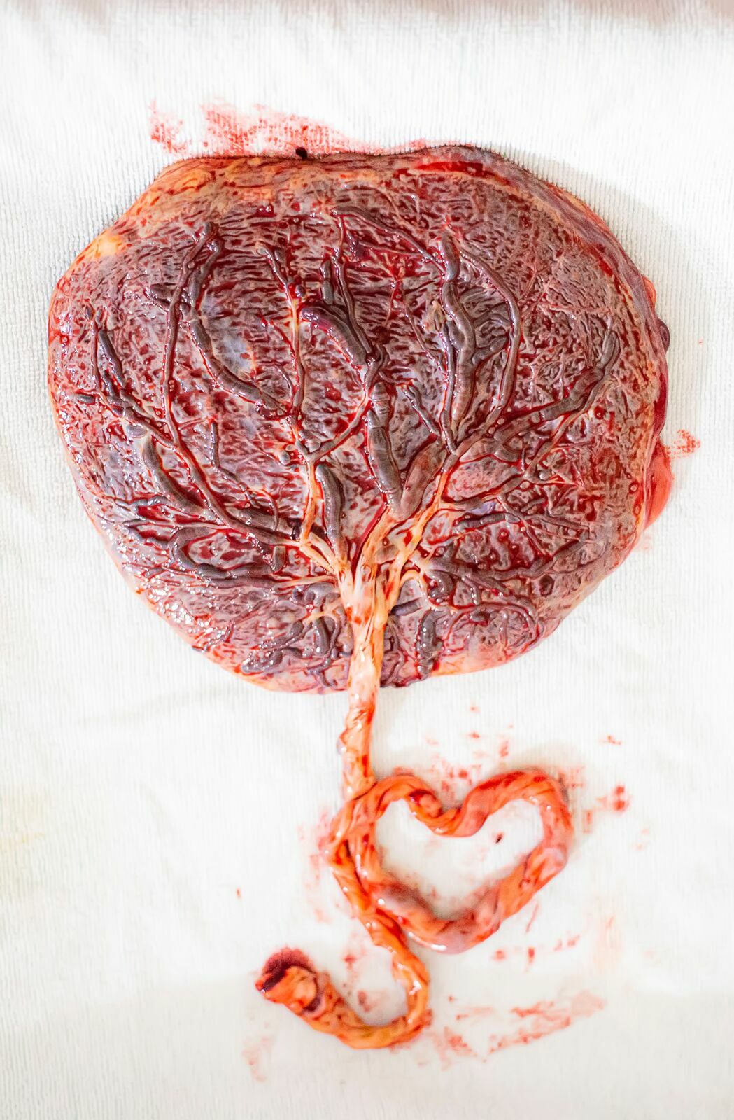 Foto Você Sabe Qual o Objetivo da Placenta? Foto Você Sabe Qual o Objetivo da Placenta? - Imagem 0
