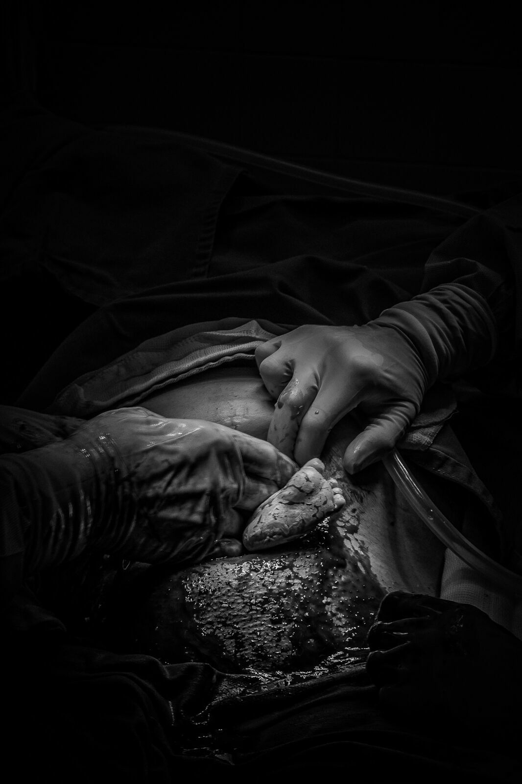 Foto O que é fotografado em um parto? Foto O que é fotografado em um parto? - Imagem 4